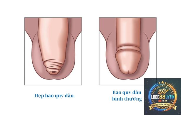 đề đầu là gì - Image 4